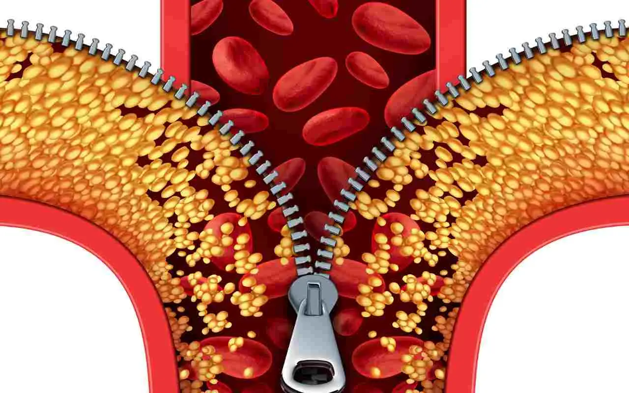 Come abbassare il colesterolo senza farmaci: il metodo che convince i medici Come abbassare il colesterolo senza farmaci: il metodo che convince i medici